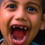Dream Interpretation of Loose Teeth In Islam