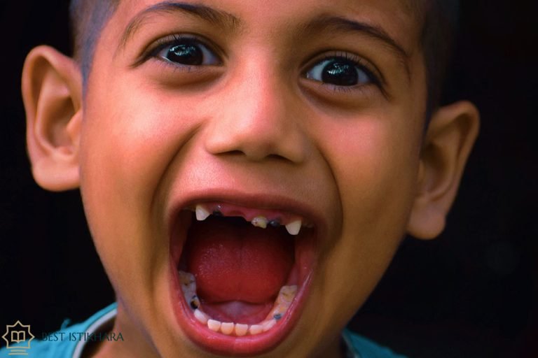 Dreams About Loose Teeth In Islam Meaning Interpretation Best Istikhara