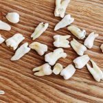 Dreaming of teeth falling