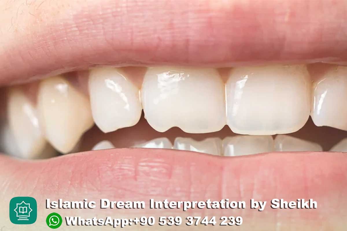 fixing teeth in dream